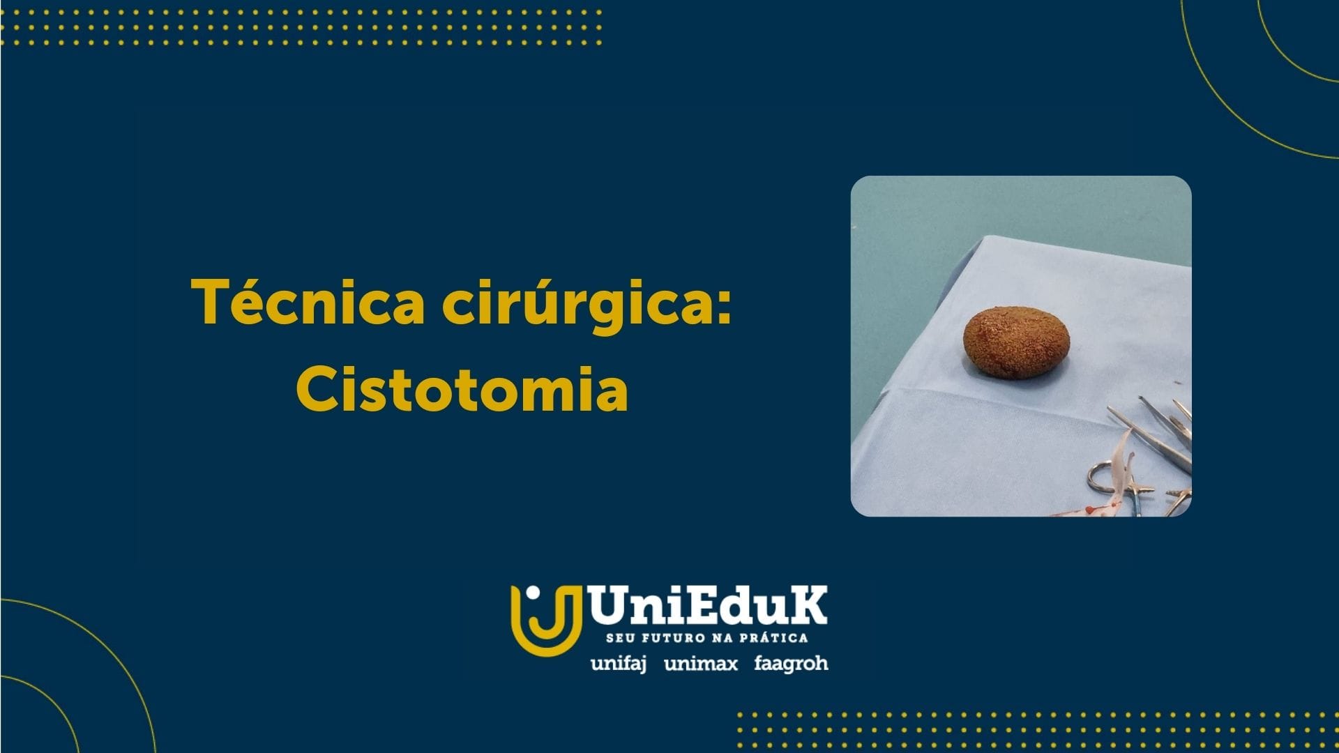 A imagem traz uma arte nos moldes do Grupo UniEduK com a imagem do cisto retirado na cirurgia.